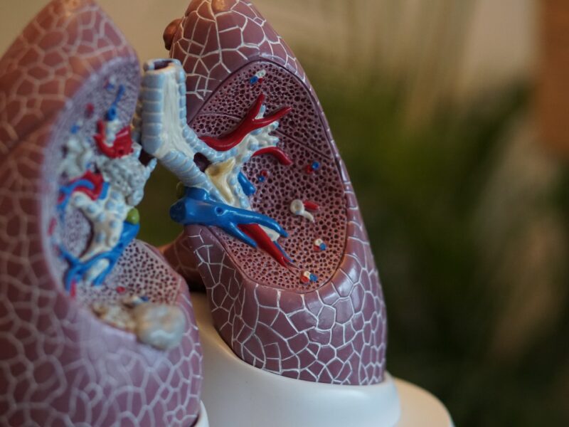 Lungenkrebs: Symptome, Ursachen und Behandlung
