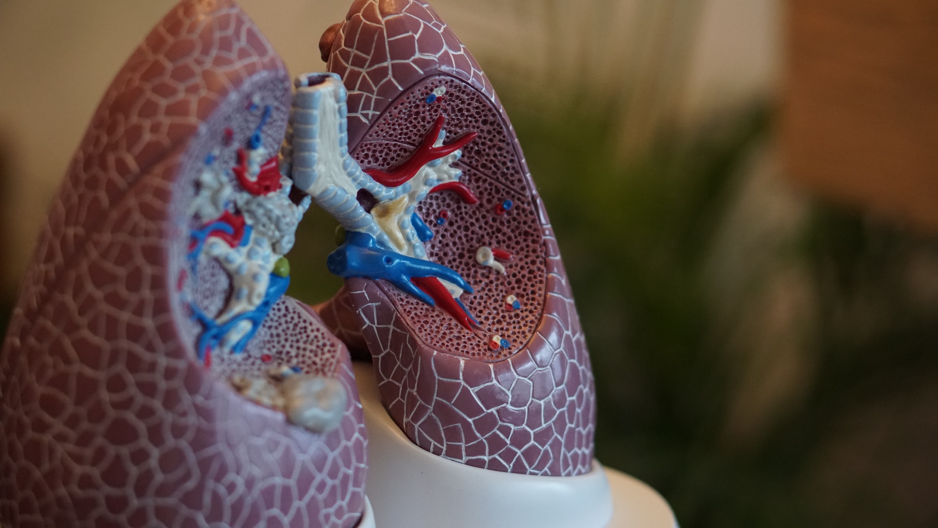 Lungenkrebs: Symptome, Ursachen und Behandlung
